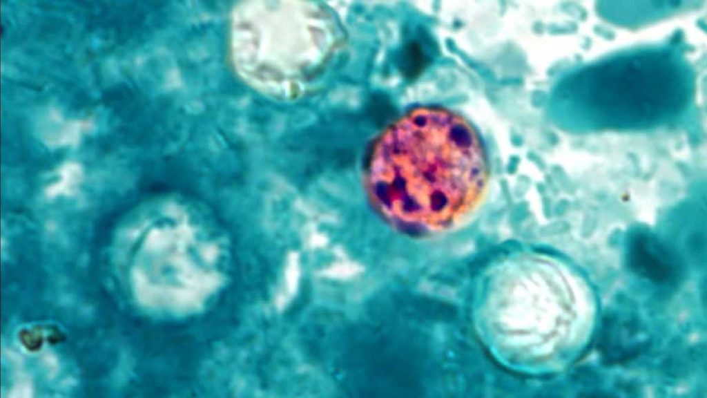Oklahoma reports 172 cases of cyclosporiasis, according to health officials