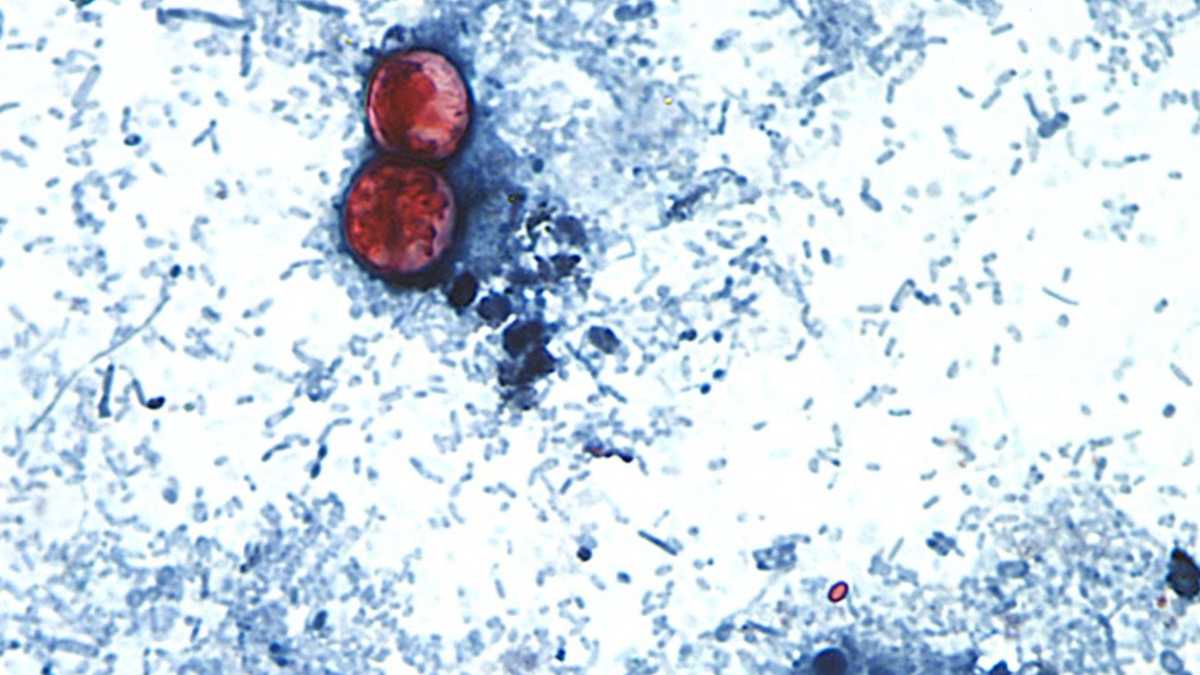 Parasitic illness leading to diarrhea reported in Kentucky