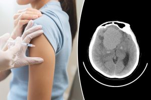 Research connects five additional contraceptive medications to brain tumor risk