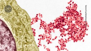 Researchers identify how a widespread virus leads to multiple sclerosis