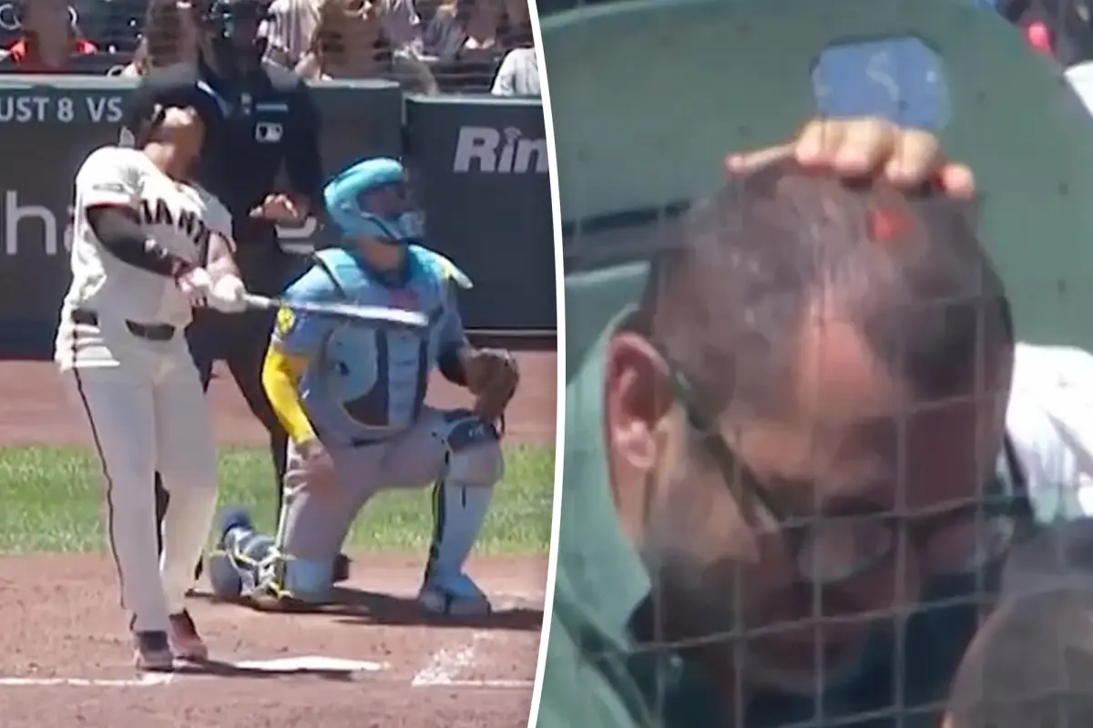 San Francisco Giants supporter injured after being hit by a foul ball