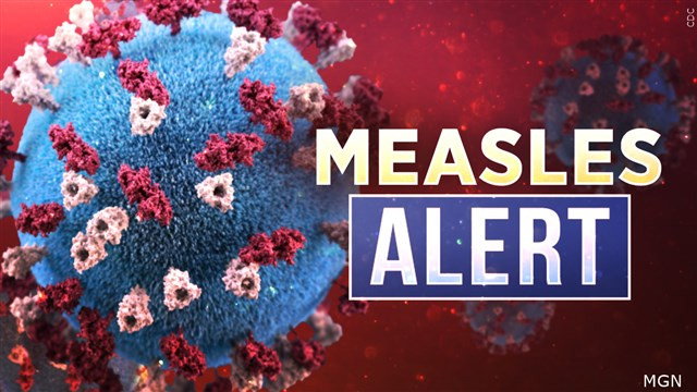 Three places in Oregon linked to measles exposure, OHA advising the public to consult their healthcare provider