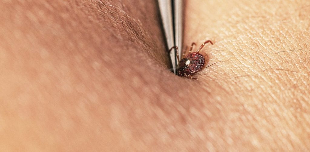 Ways to prevent tick bites in your yard or during hikes, and what to do if one bites you