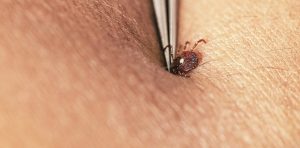 Ways to prevent tick bites in your yard or during hikes, and what to do if one bites you