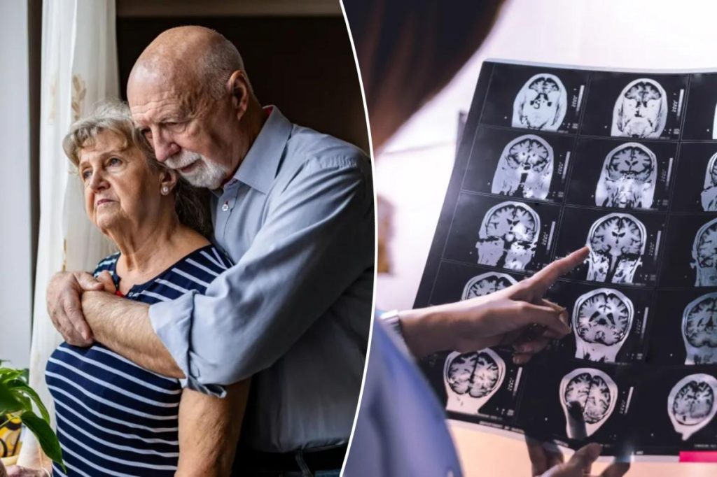 Your spouse might raise your chances of developing dementia
