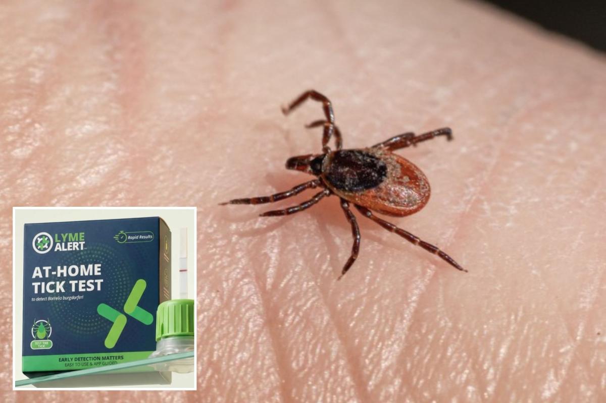 ‘TickCrusher’ kit assesses Lyme disease anxiety in 15 minutes