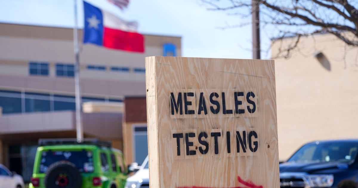 As measles outbreaks increase in the U.S., maps and graphs reveal a historic high in cases