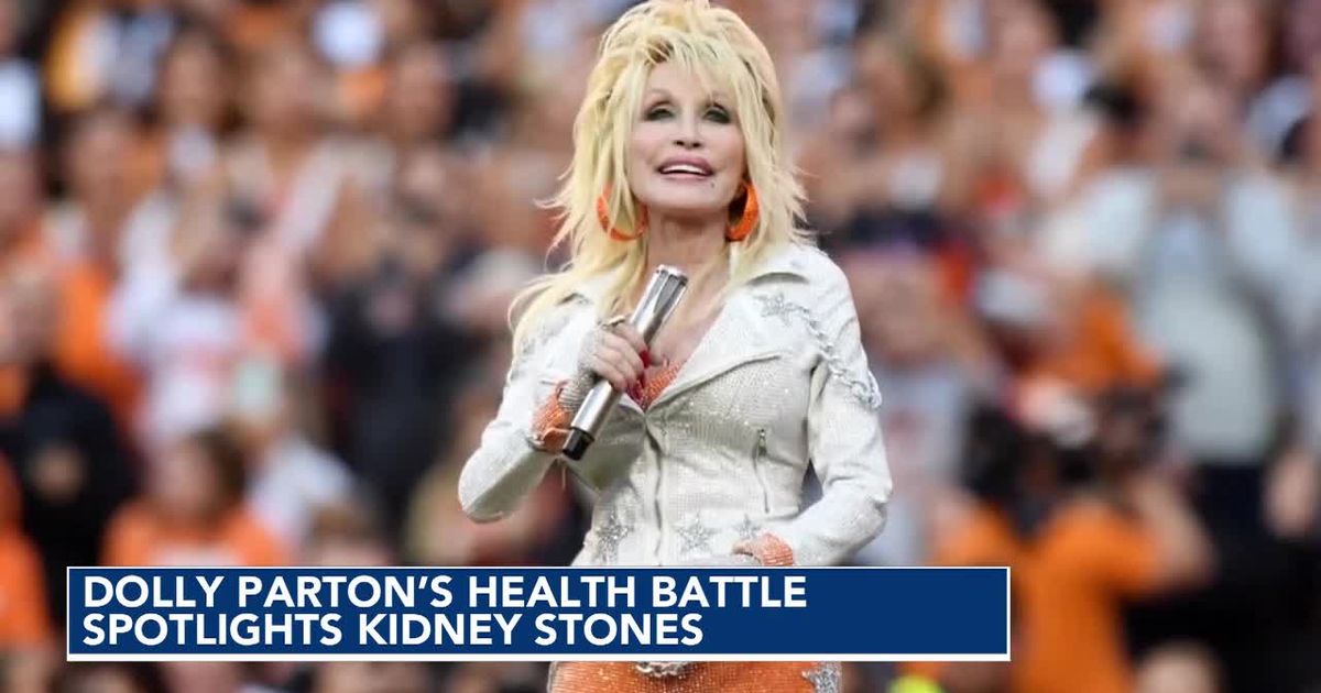Dolly Parton battled kidney stones for many years. Here are the signs to look out for.