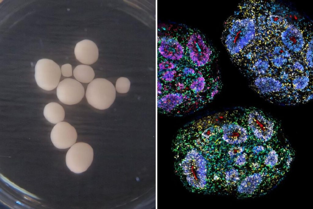Oldest lab-grown human brains in the world develop over seven years, marking the 'passage of time'