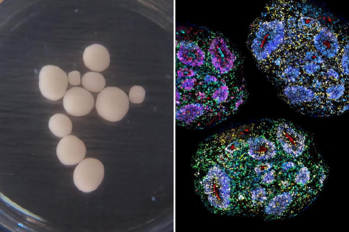 Oldest lab-grown human brains in the world develop over seven years, marking the 'passage of time'