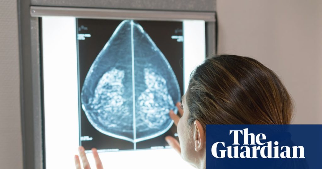Study indicates AI can identify heart disease in women through mammograms
