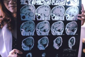 A family's battle with early dementia might guide us toward a cure.