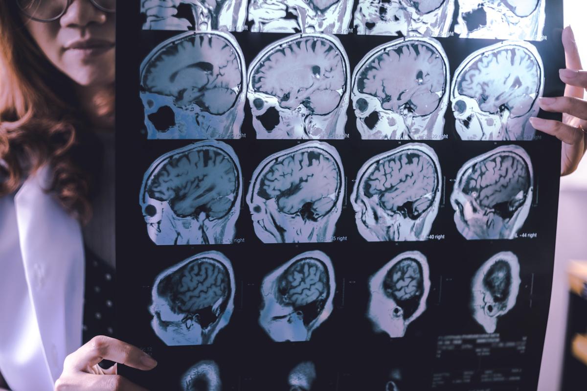 A family's battle with early dementia might guide us toward a cure.