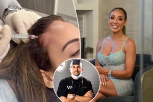 How I revitalized Melissa Gorga’s thinning hair