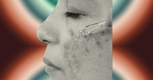 It's a Great Moment to Begin Your Melasma Regimen: Products