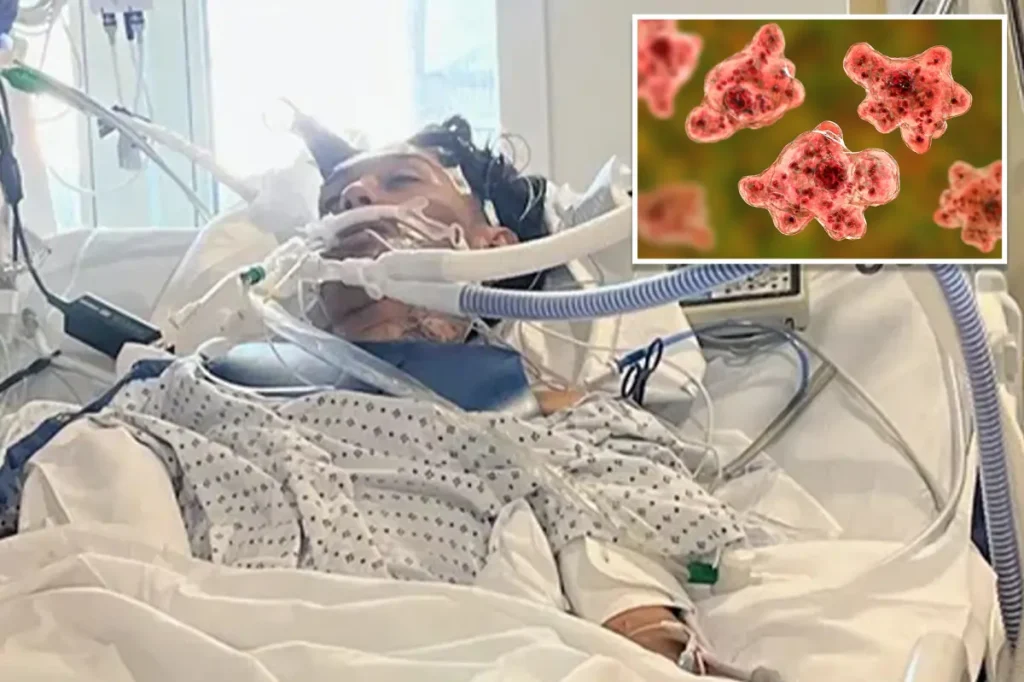 North Carolina teenager passes away due to uncommon brain-eating amoeba