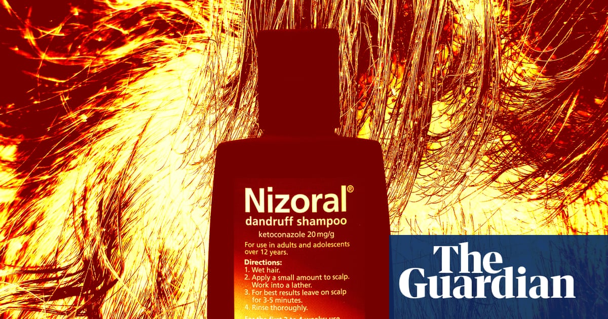 Practical but ordinary: tips for handling dandruff at home and knowing when to seek assistance