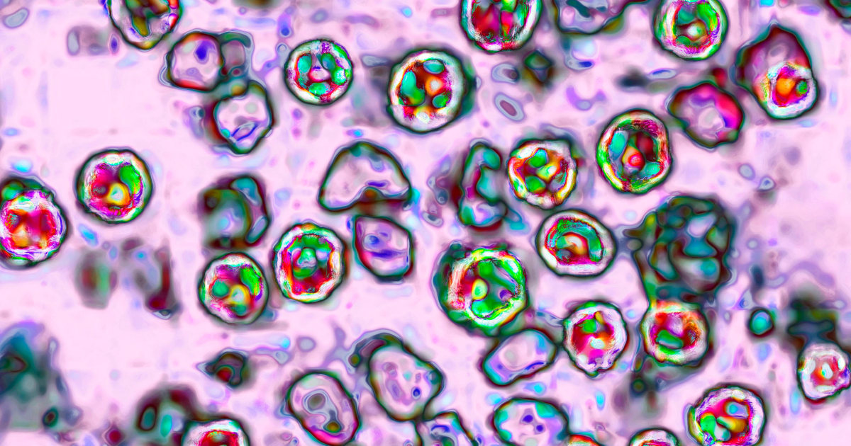 Teen from Pennsylvania dies due to complications from measles, marking the fourth death in the state.