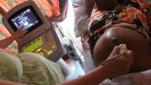 The Trump administration stated it would focus on stopping HIV transmission from mother to child, but health workers claim it reduced services.