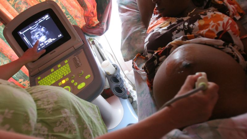 The Trump administration stated it would focus on stopping HIV transmission from mother to child, but health workers claim it reduced services.