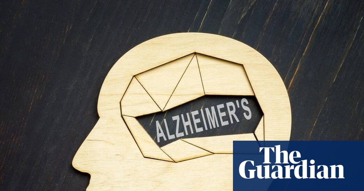 Trial to assess drug on those without symptoms to explore prevention of Alzheimer&rsquo;s