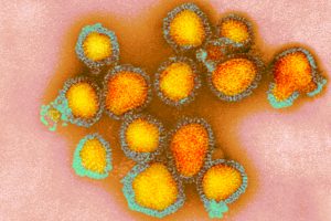Bay Area becomes the center of flu cases in California