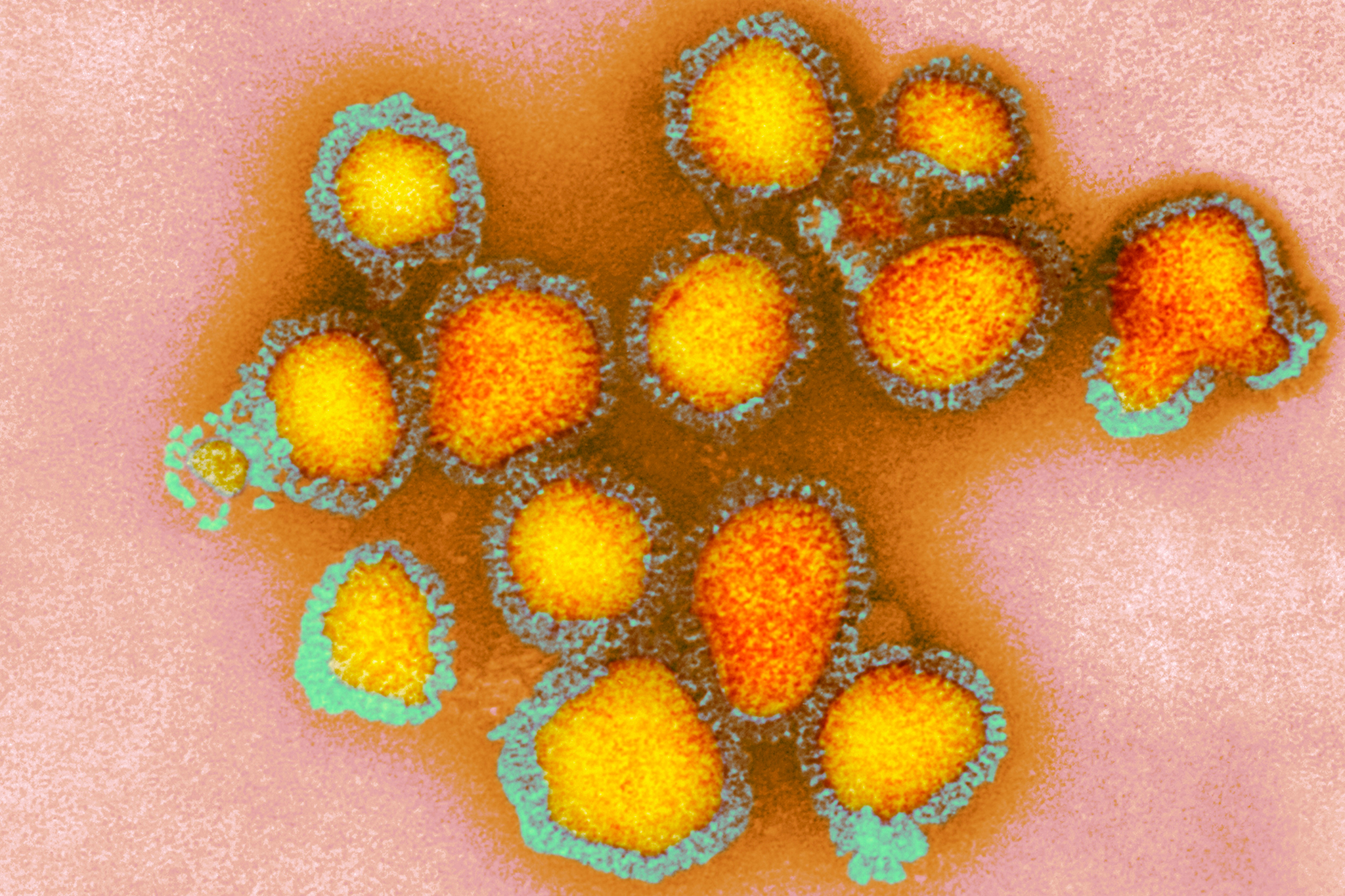 Bay Area becomes the center of flu cases in California