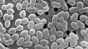 Consuming sugar while on antibiotics could negatively affect gut bacteria