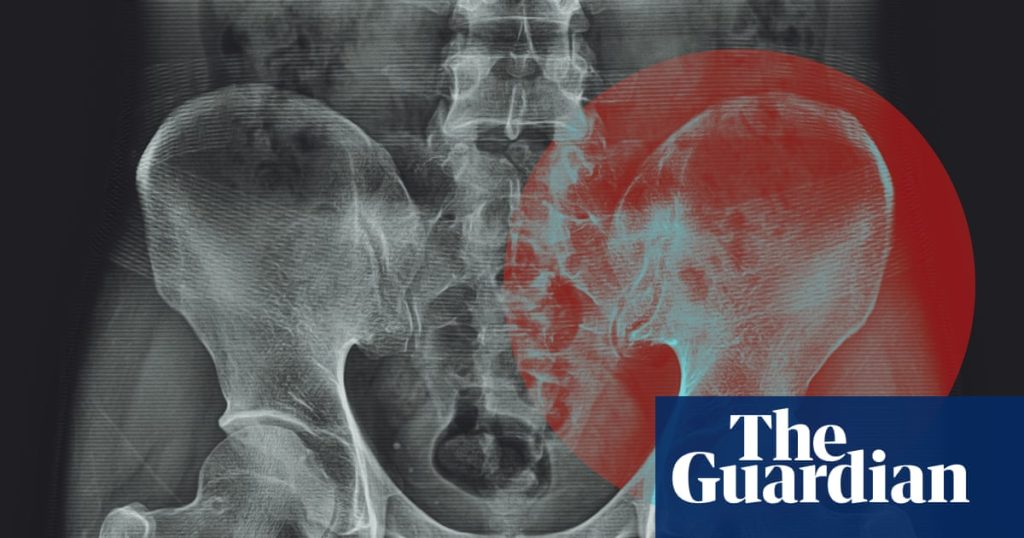 Do we actually store tension in our hips?