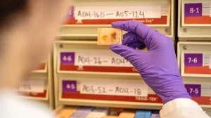 Documents reveal a $765 cost for each organ after thorough investigation