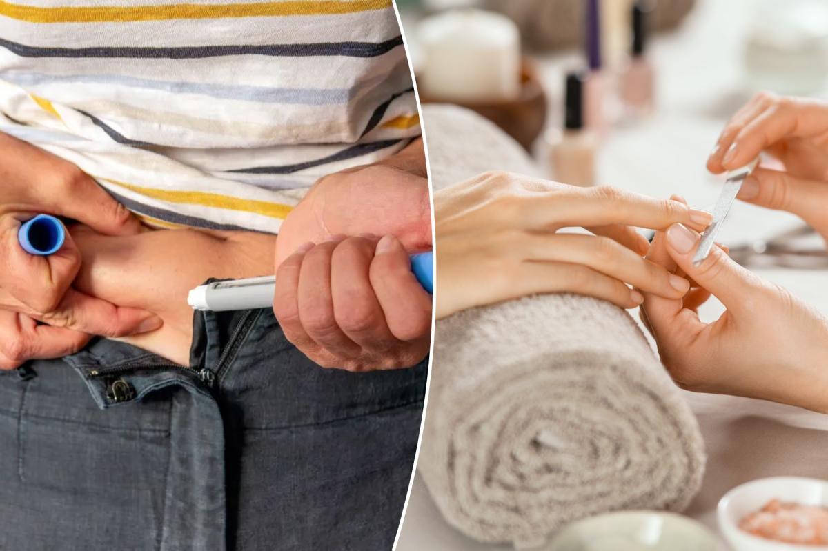GLP-1s associated with an unpleasant nail side effect: study