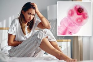Medication for tapeworms may help with a disease impacting 190 million women.