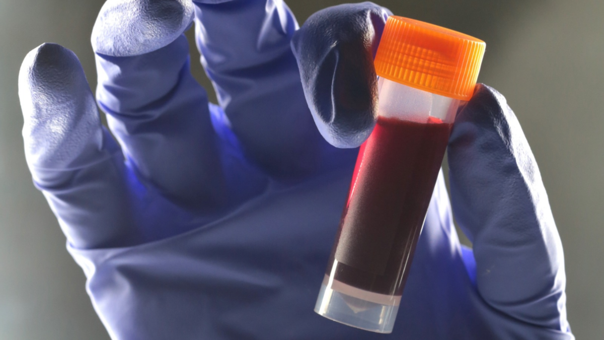 One blood type appears to be associated with an increased risk of type 2 diabetes.