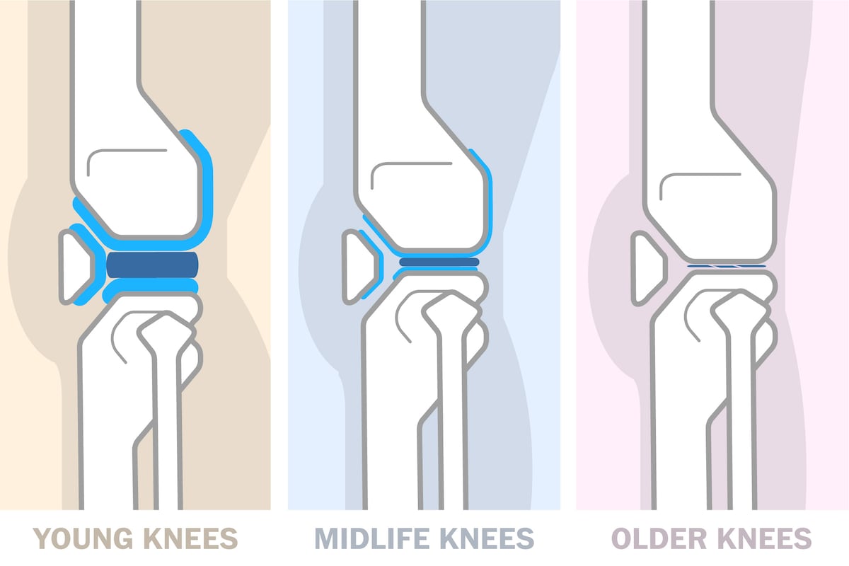 Ways to look after your knees in your 20s, 30s, 40s and later